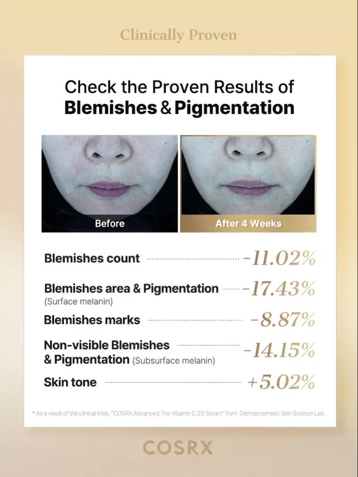 Before-and-after photos from COSRX Advanced The Vitamin C 23 Serum clinical study showing visible reduction in blemishes and pigmentation after 4 weeks; results include -17.43% surface pigmentation and +5.02% tone improvement, backed by Dermacosmetic Skin Science Lab testing.