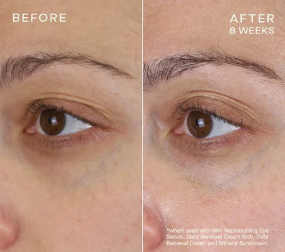 Advanced Regenerative Eye Serum