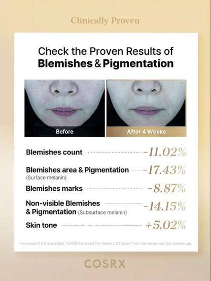 Before-and-after photos from COSRX Advanced The Vitamin C 23 Serum clinical study showing visible reduction in blemishes and pigmentation after 4 weeks; results include -17.43% surface pigmentation and +5.02% tone improvement, backed by Dermacosmetic Skin Science Lab testing.
