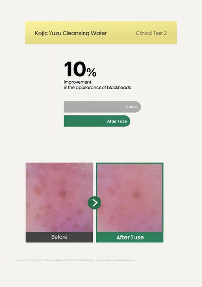 AXIS-Y Kojic Yuzu Cleansing Water 250ml — blackhead results; original brand product information