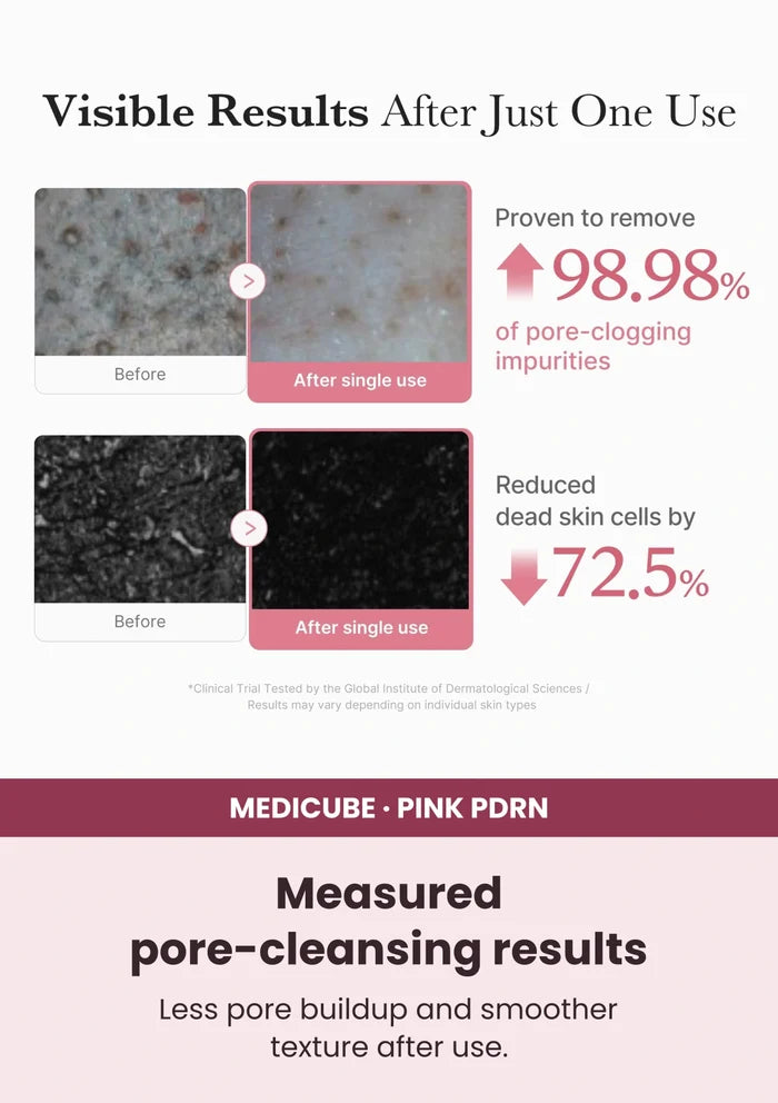 Medicube PDRN Pink Niacinamide Whip Cleanser — Tested cleansing and texture care. Less pore buildup and smoother texture after use.