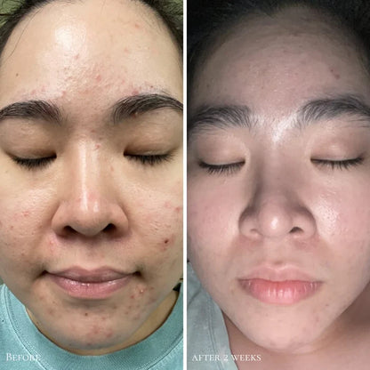 Probiotic Triple Action Clarifying Pads